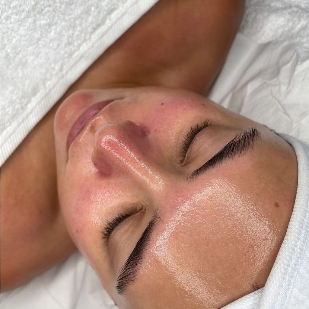 Instagram post kozmetičkog salona Skin Lab
